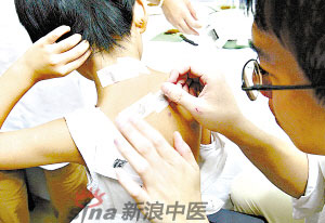 灸法的種類  你知道多少？